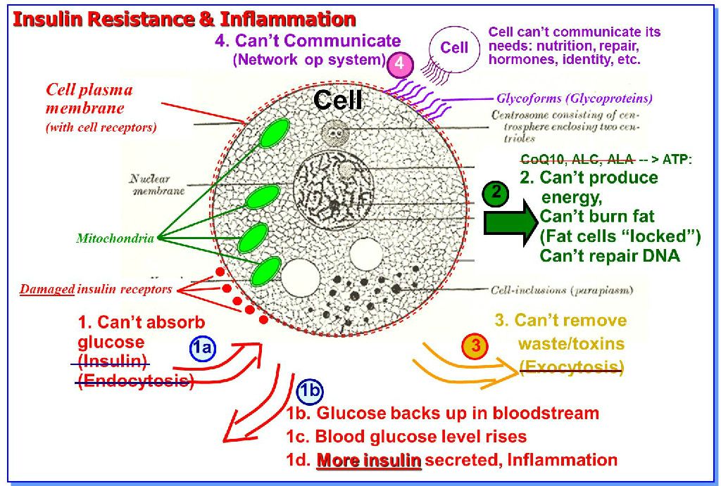 diabetes pathophysiology