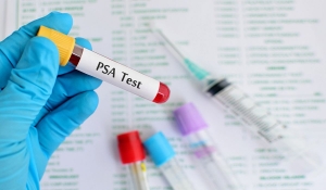 Τι είναι το PSA; (Prostate Specific Antigen)